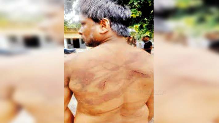 Lucknow: Robbers looted Rs 50 Thousand and Brutally Beaten to Man