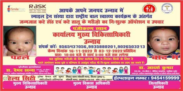 free-registration-camp-for-cleft-lip-and-cleft-palate-by-birth1